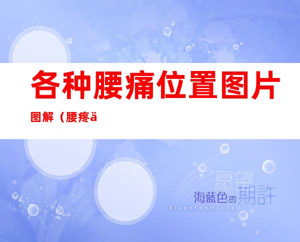 各种腰痛位置图片图解(腰疼位置图解)