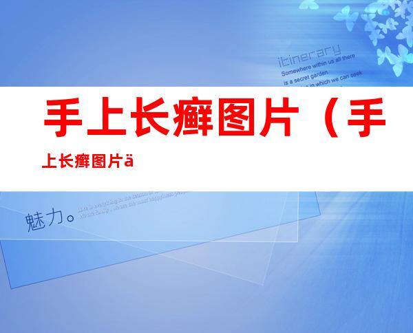 手上长癣图片(手上长癣图片会传染不)