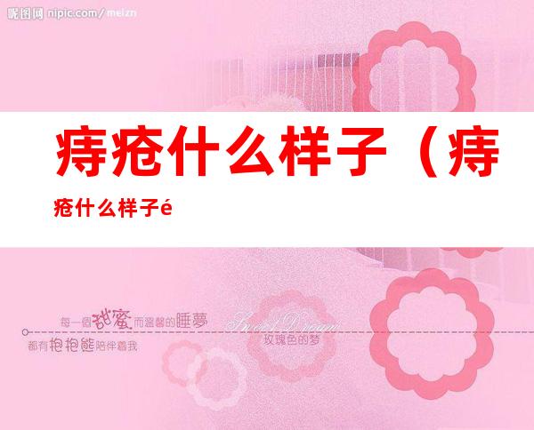 痔疮什么样子(痔疮什么样子需要手术)