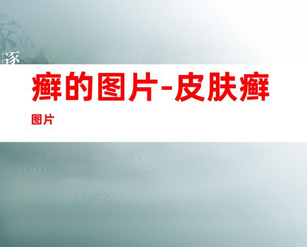 癣的图片-皮肤癣图片