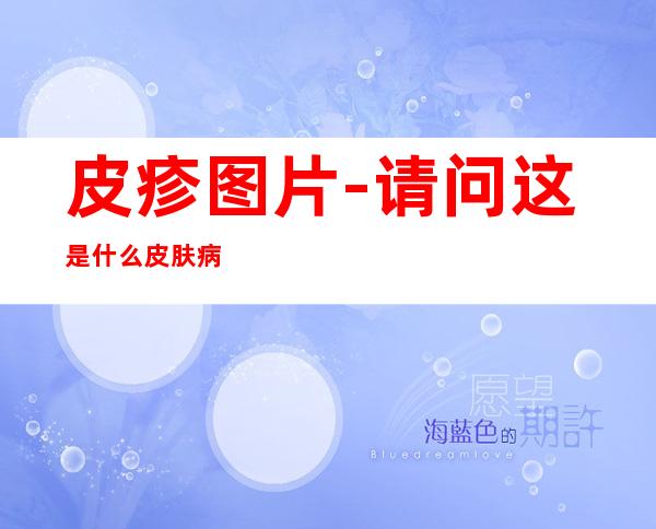 皮疹图片-请问这是什么皮肤病?
