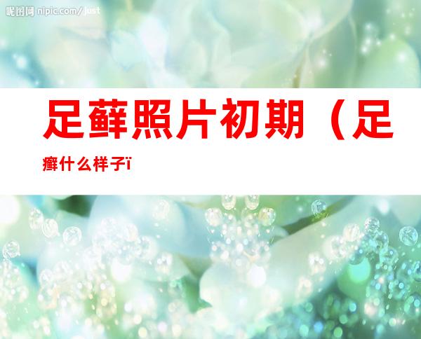 足藓照片初期(足癣什么样子)
