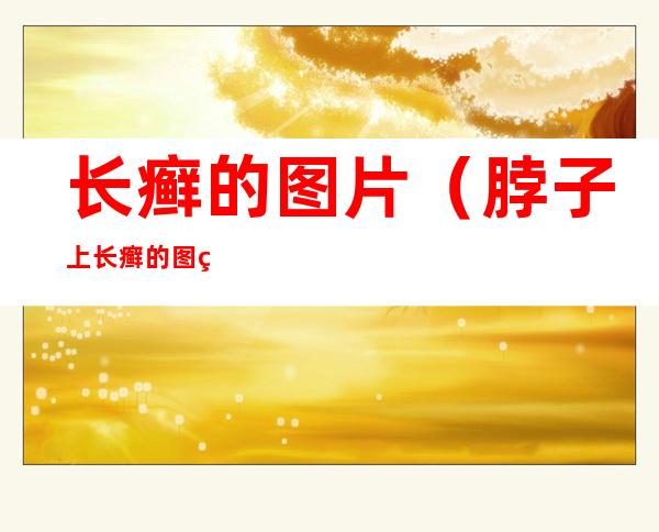 长癣的图片（脖子上长癣的图片）
